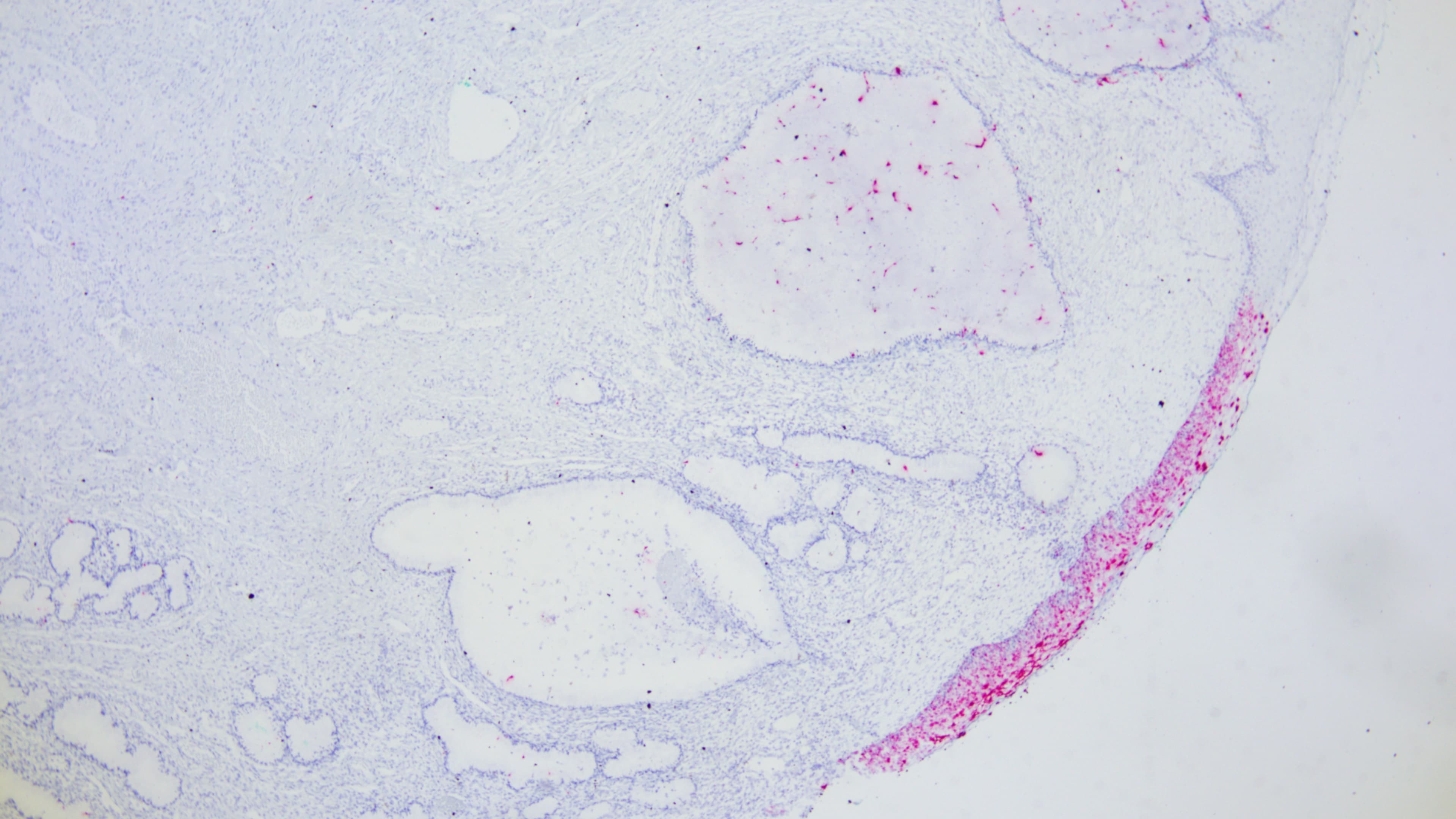 HPV