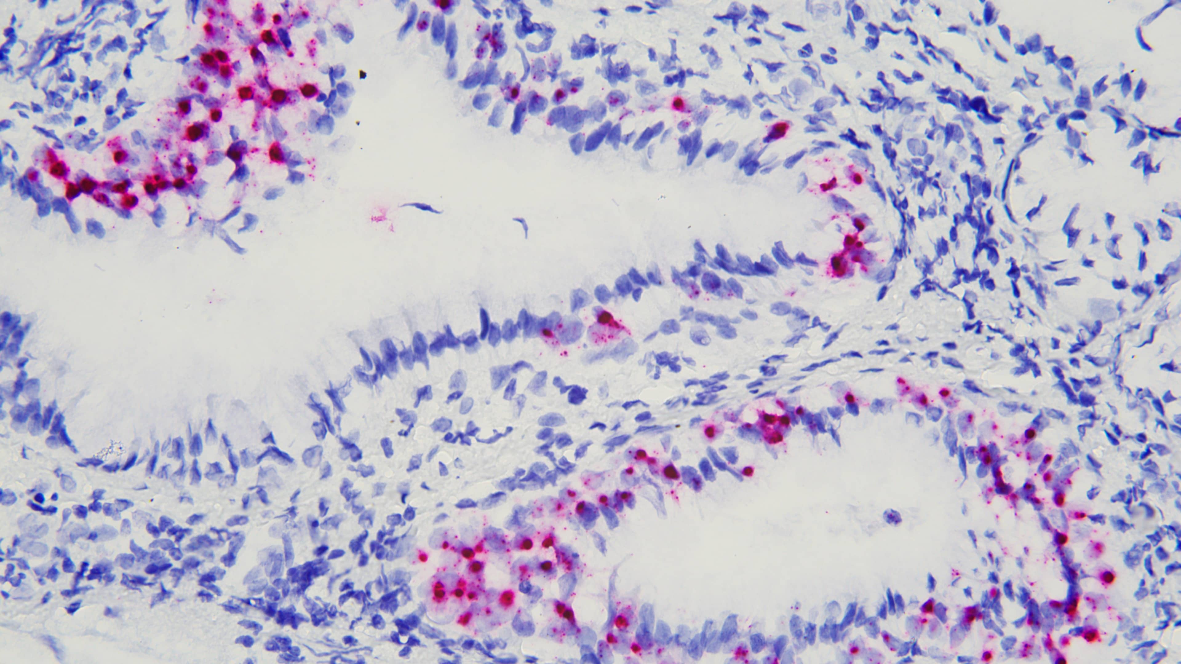 HPV