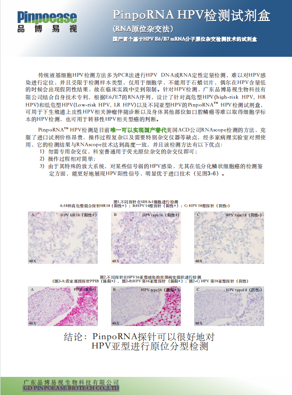 HPV+EB