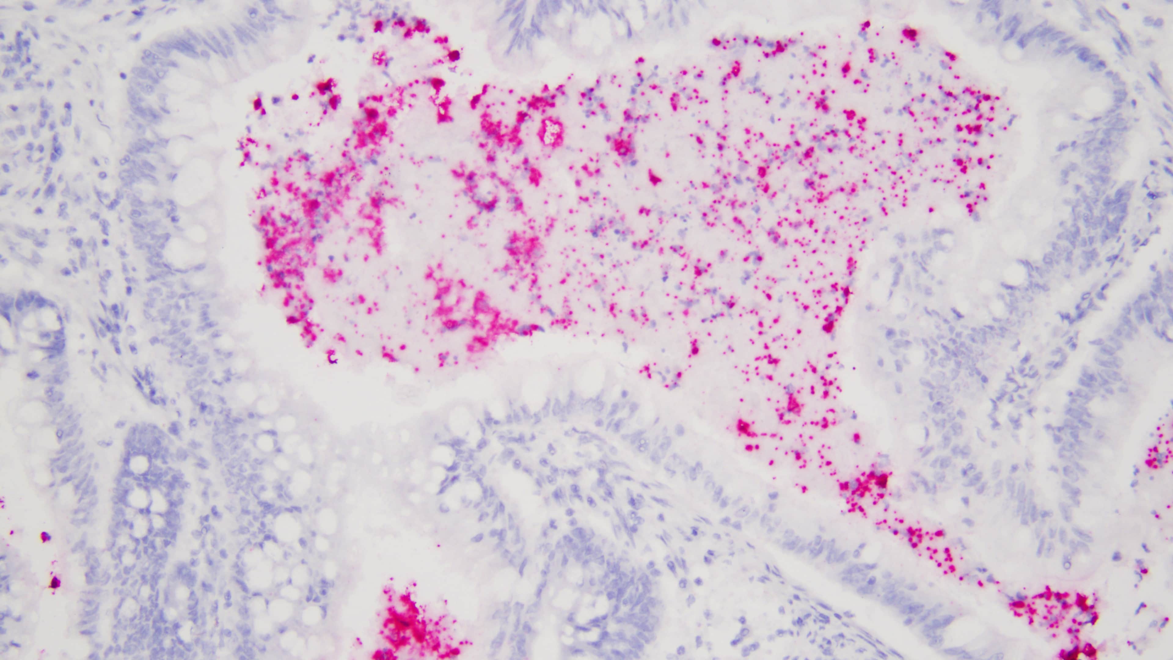 Gut microbiome