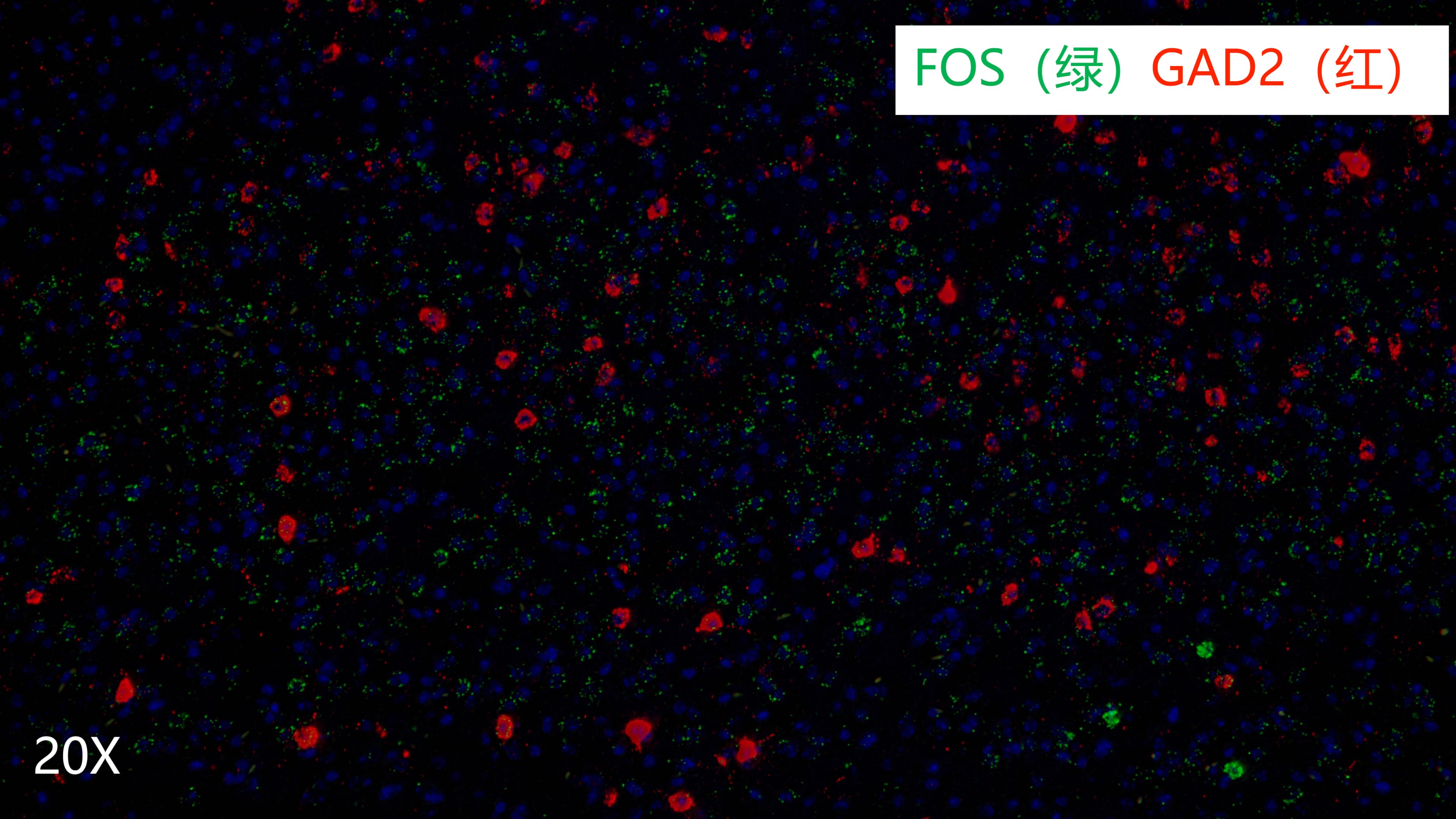 mouse brain