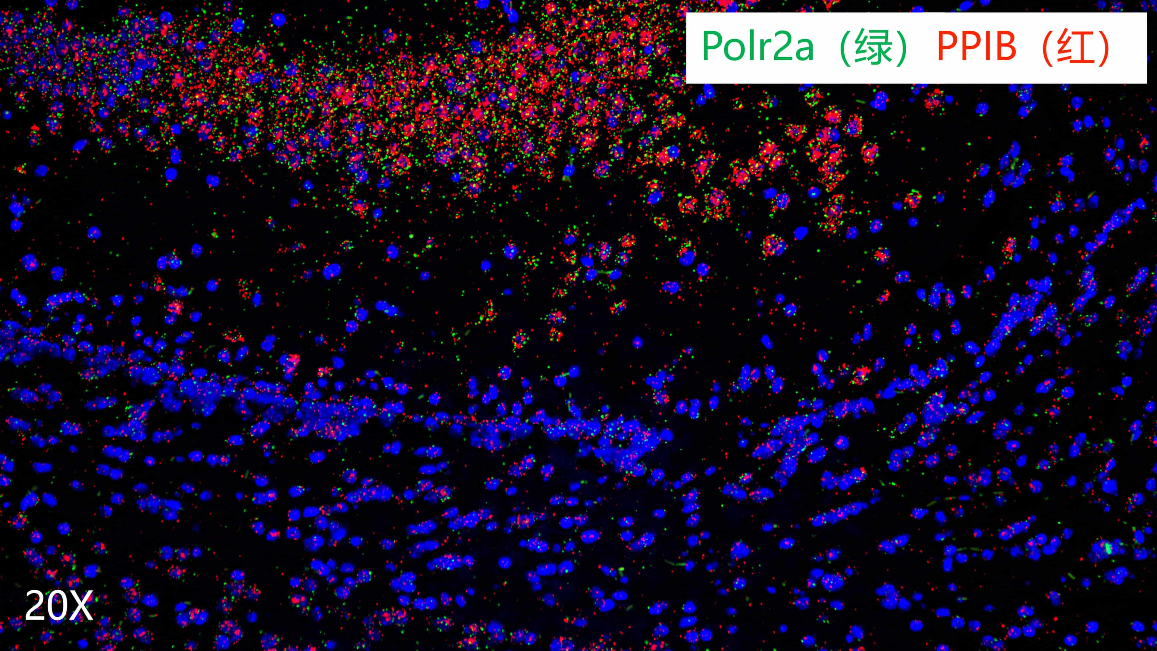  mouse brain
