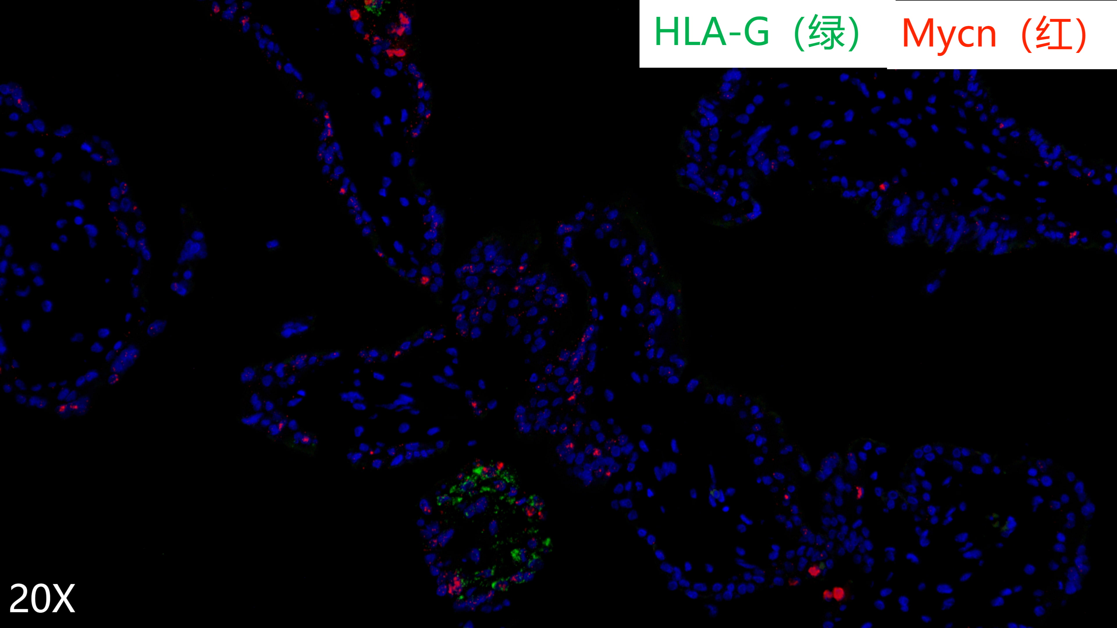 human villi 