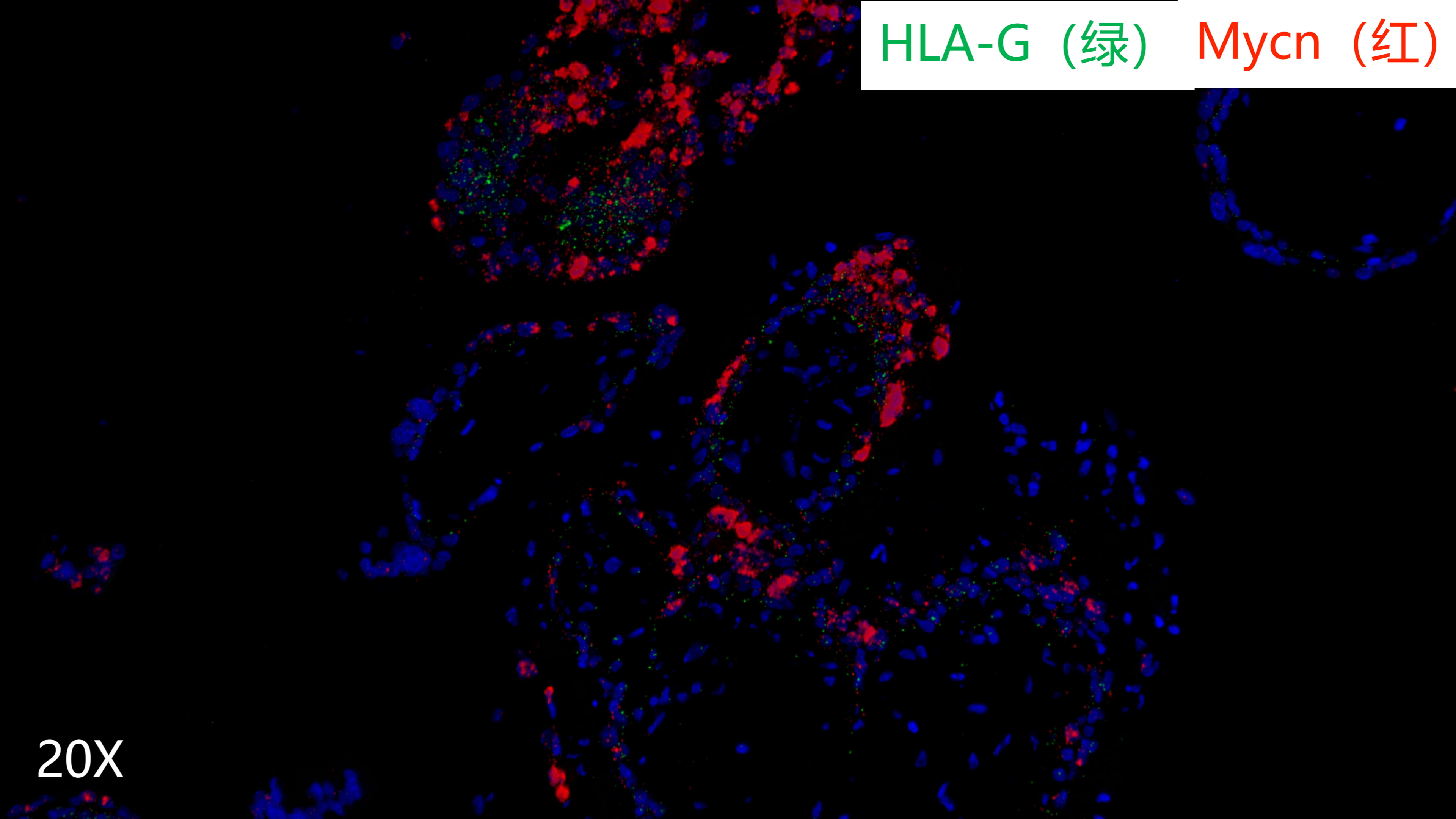 human villi 
