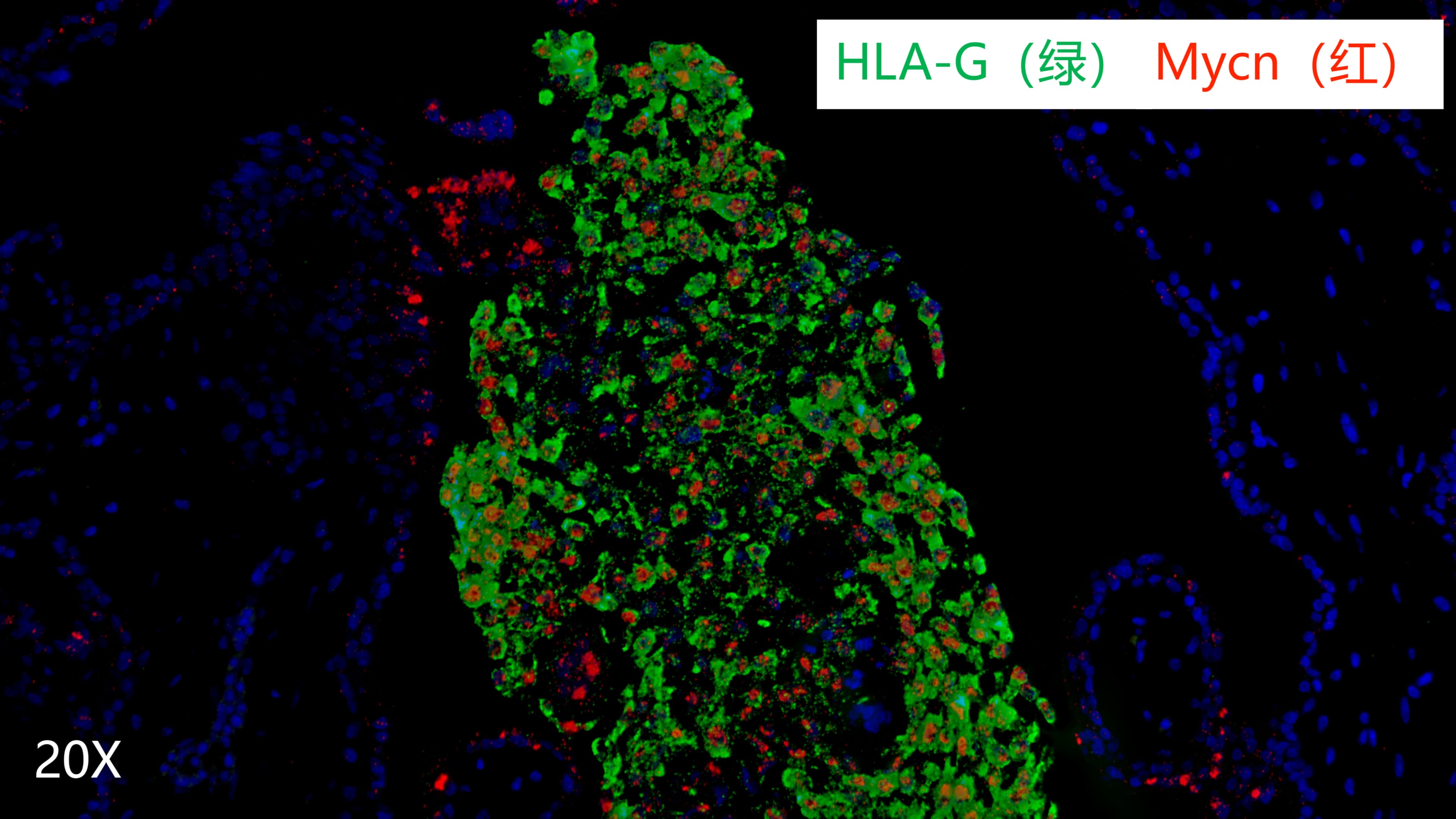 human villi 