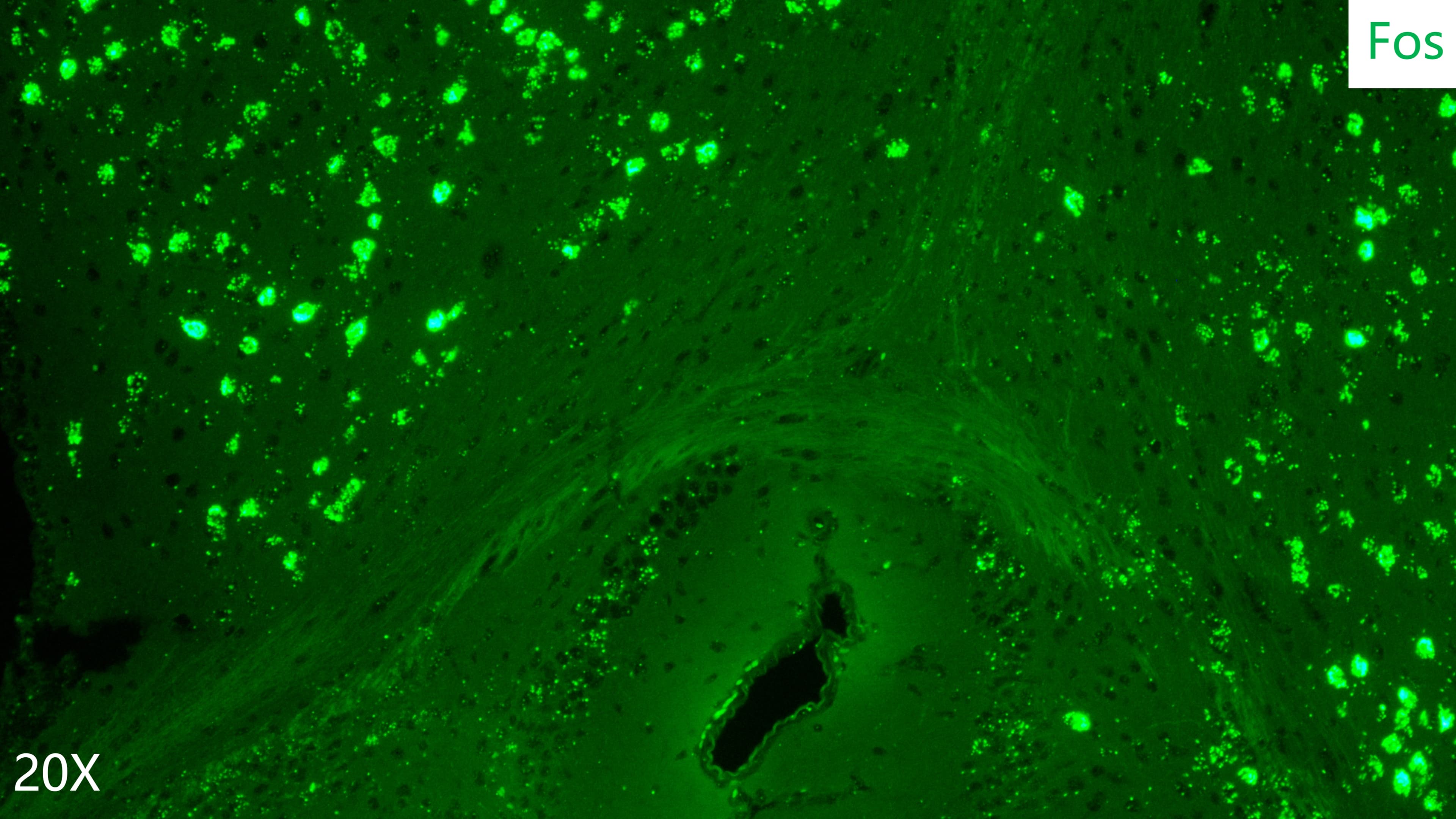 mouse brain