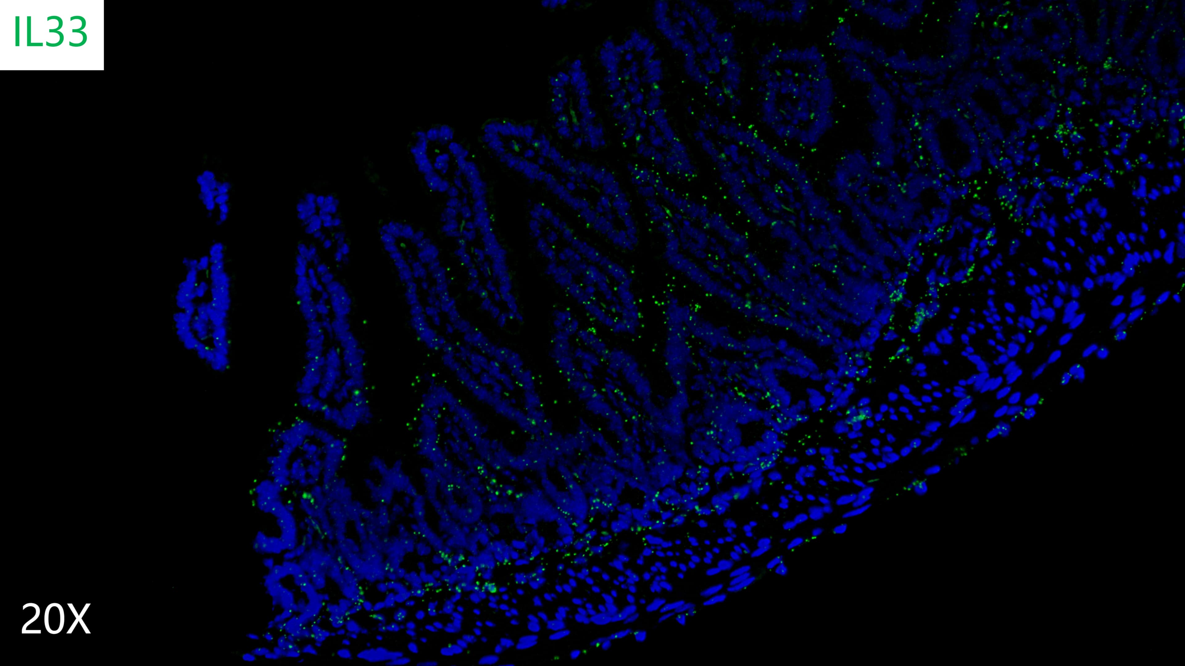 mouse intestine