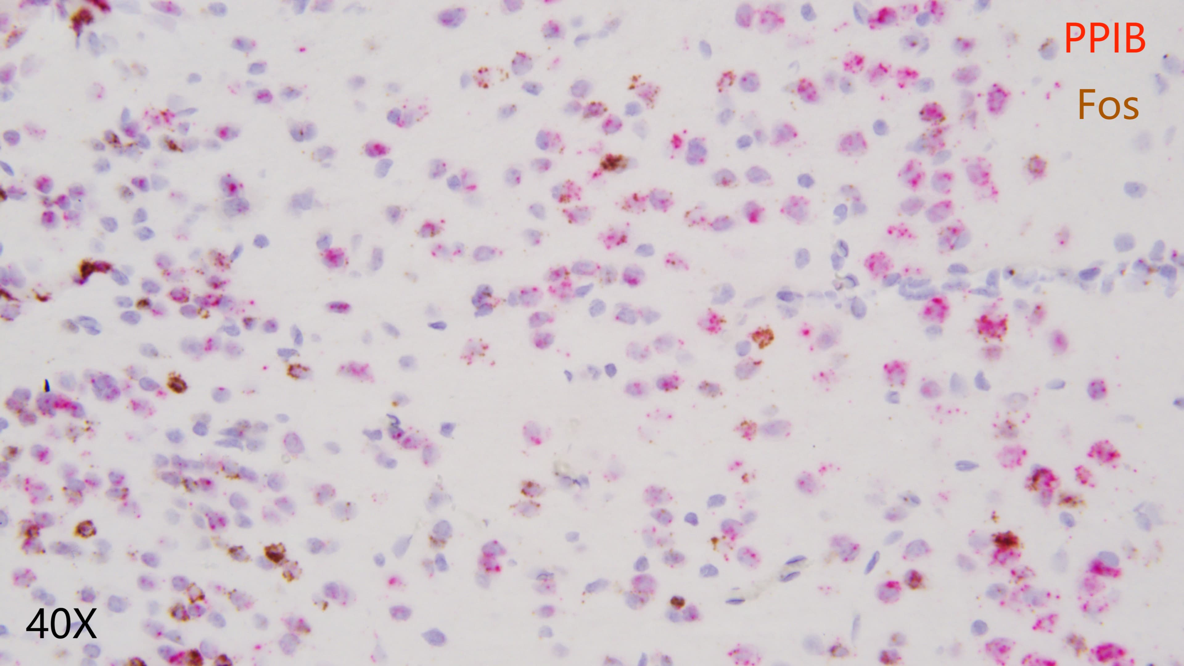 mouse brain