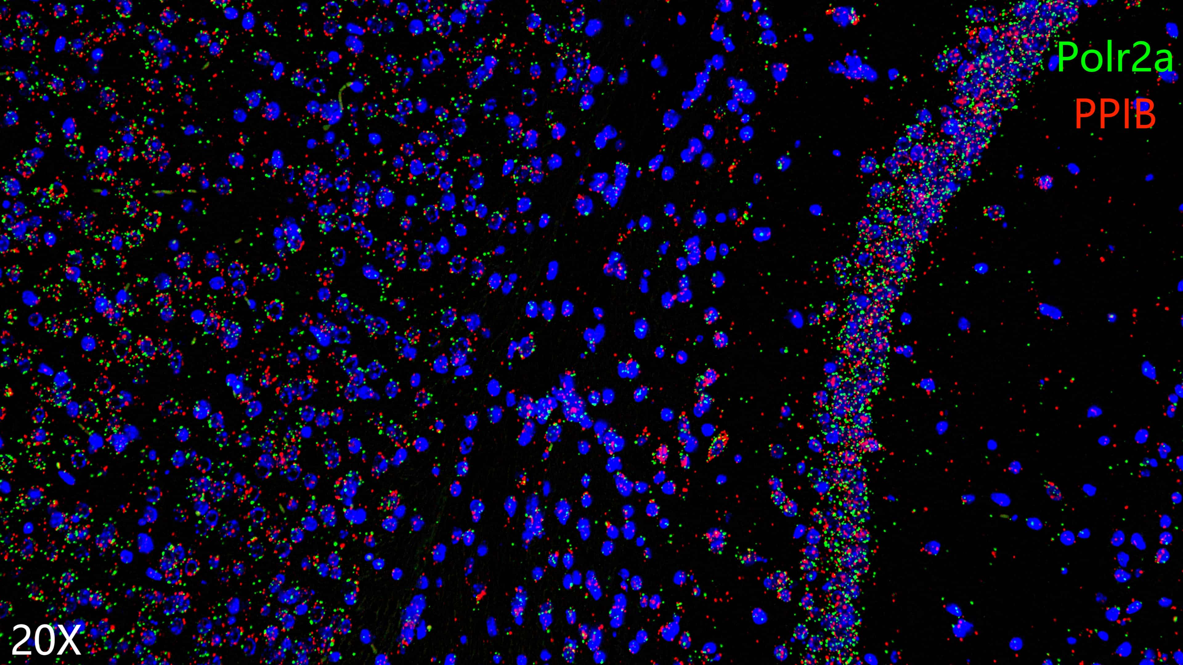  mouse brain